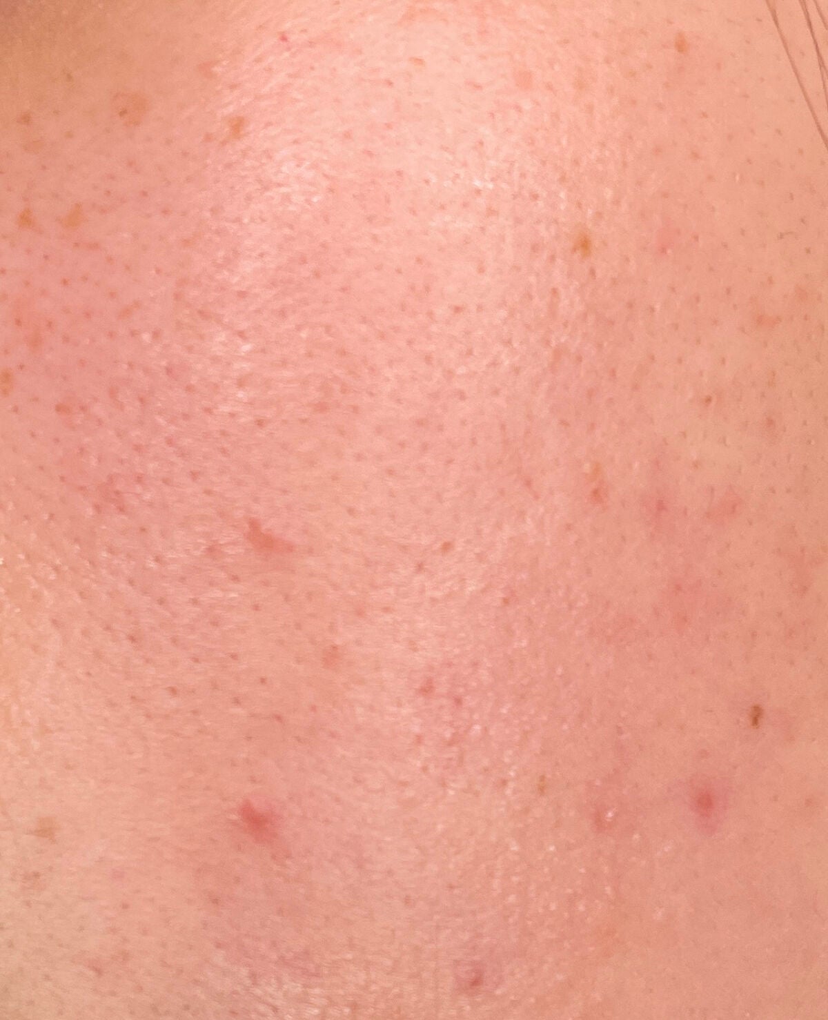 GO ã¯ãã·ã§ã³/ãŽã¡ã¬ã³ãã£ã ãã¥ãŒãã£/ã¯ãã·ã§ã³ãã¡ã³ããŒã·ã§ã³ã䜿ã£ãã¯ãã³ãïŒ5æç®ïŒ