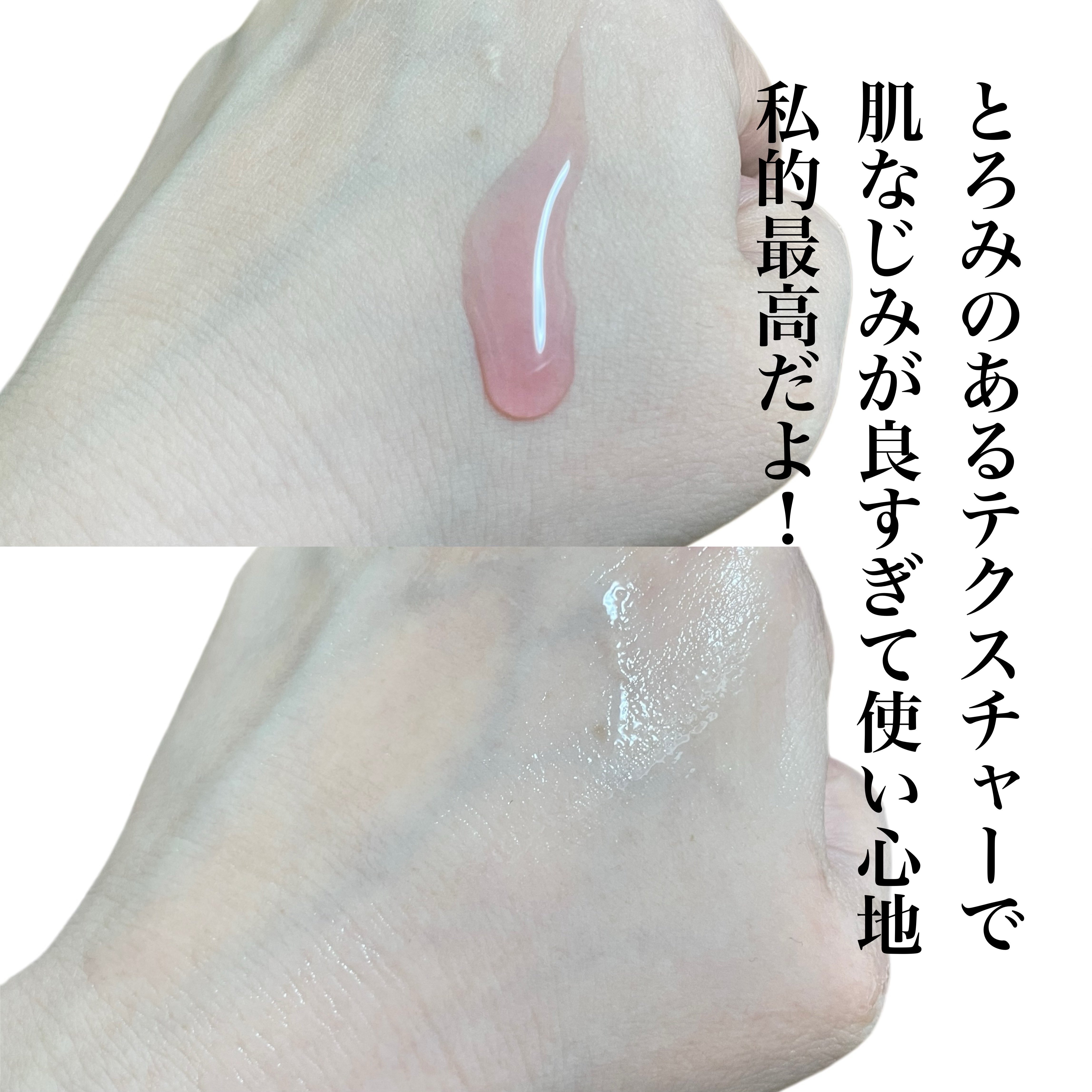 ダークスポットセラム/Anua/美容液を使ったクチコミ（3枚目）