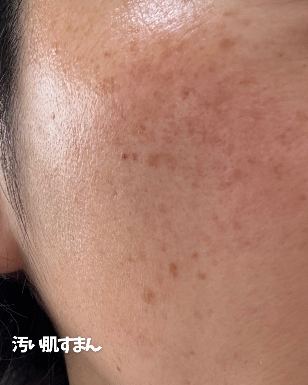 ダーマシンコンシーラー/23years old/リキッドコンシーラーを使ったクチコミ(3枚目)