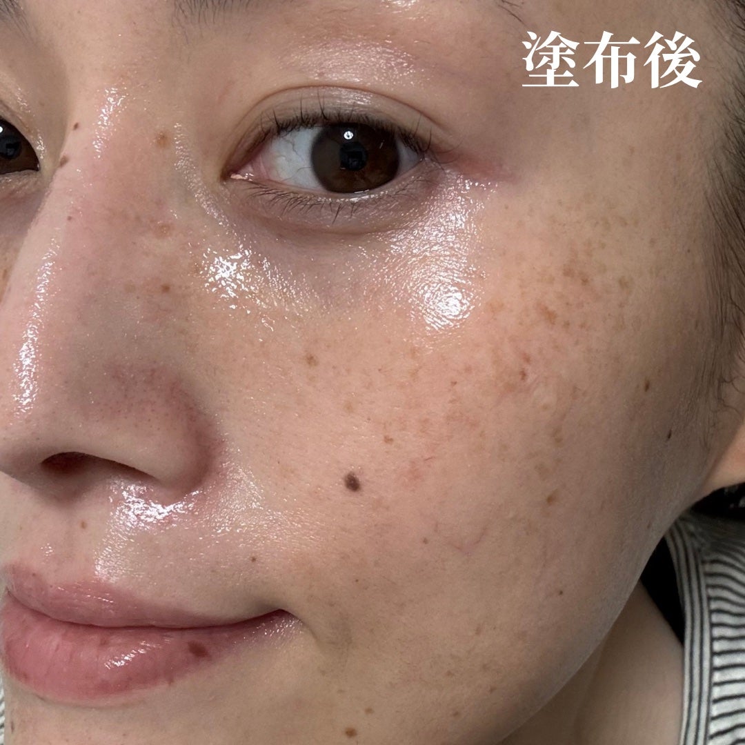 ターンオーバーアンプル/REJURAN COSMETICS/美容液を使ったクチコミ(6枚目)