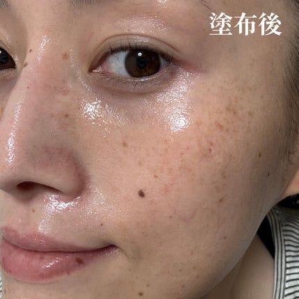 ターンオーバーアンプル/REJURAN COSMETICS/美容液を使ったクチコミ(6枚目)