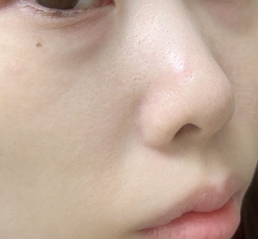 ダヴ 吸着毛穴ケア 洗顔ジェル/ダヴ/その他洗顔料を使ったクチコミ（3枚目）