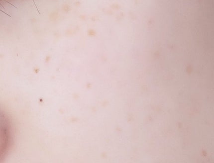 オイルクレンジングバーム ホワイトプレミアム/ONE STONE TWO BIRDS/クレンジングバームを使ったクチコミ(6枚目)