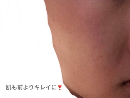 化粧水・敏感肌用・高保湿タイプ/無印良品/化粧水を使ったクチコミ(3枚目)