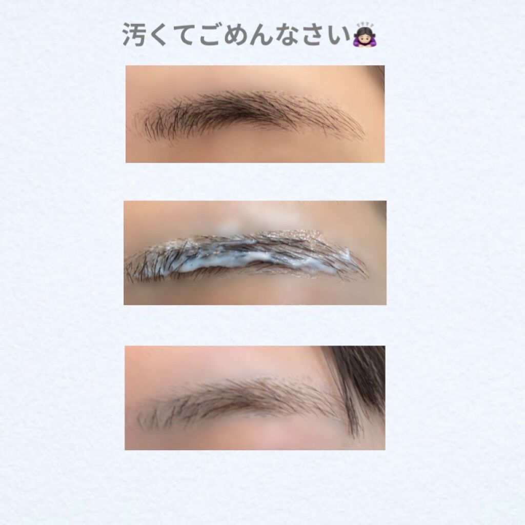 脱色クリーム スピーディー/エピラット/ムダ毛ケアを使ったクチコミ（2枚目）