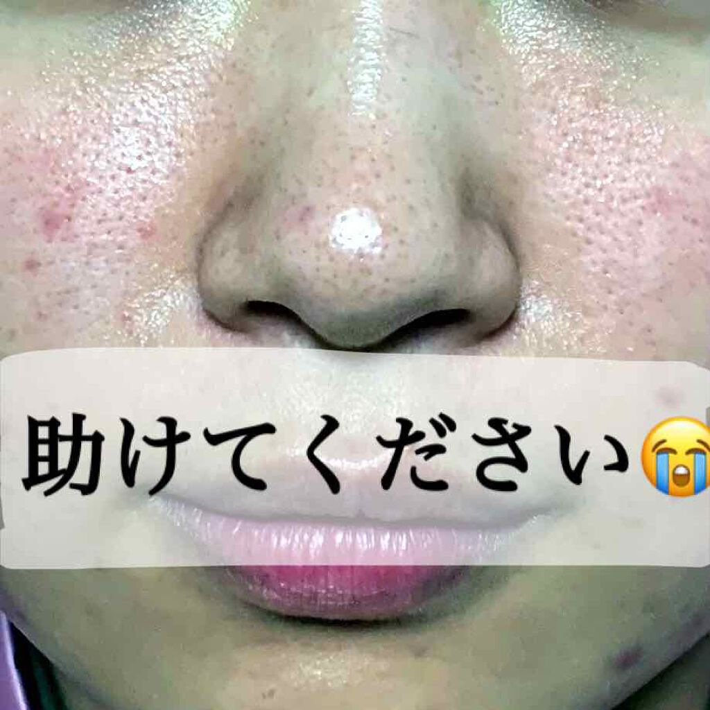 クリアウォッシュ/オルビス/洗顔フォームを使ったクチコミ（1枚目）