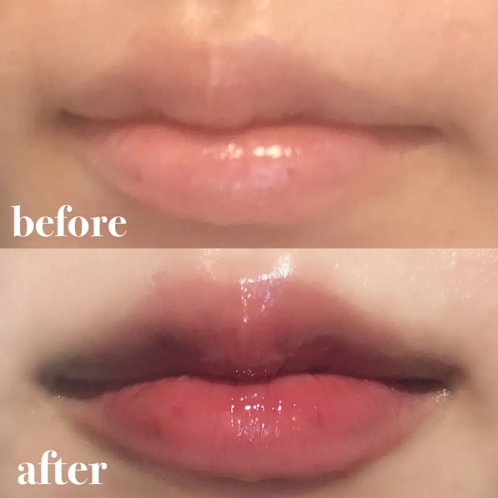 韓国アイドル風リップ　before　after