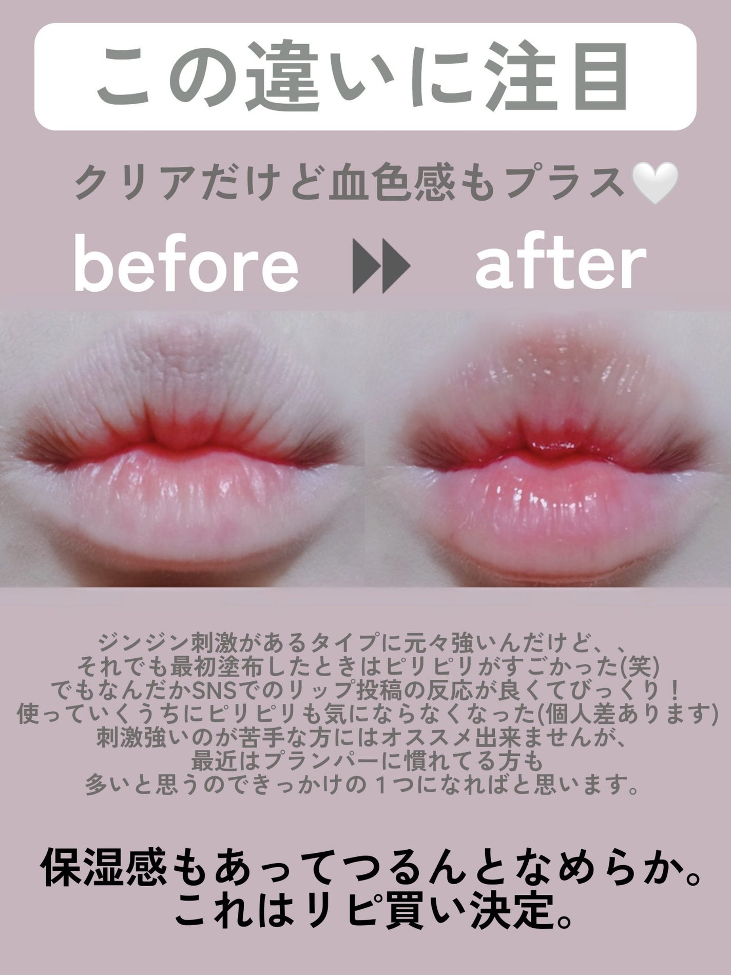 オールマイシングス トゥルービューティ キス リッププランパー/all my things/リッププランパーを使ったクチコミ(4枚目)