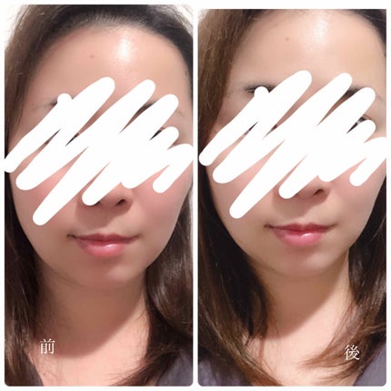 トニーシュア/トニーシュア/美顔器・マッサージを使ったクチコミ(2枚目)