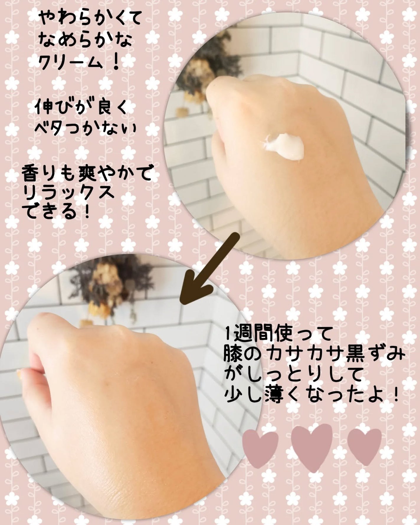 BnDアンダーアームクリーム(ボディクリーム)/BnD/デリケートゾーンケアを使ったクチコミ(4枚目)