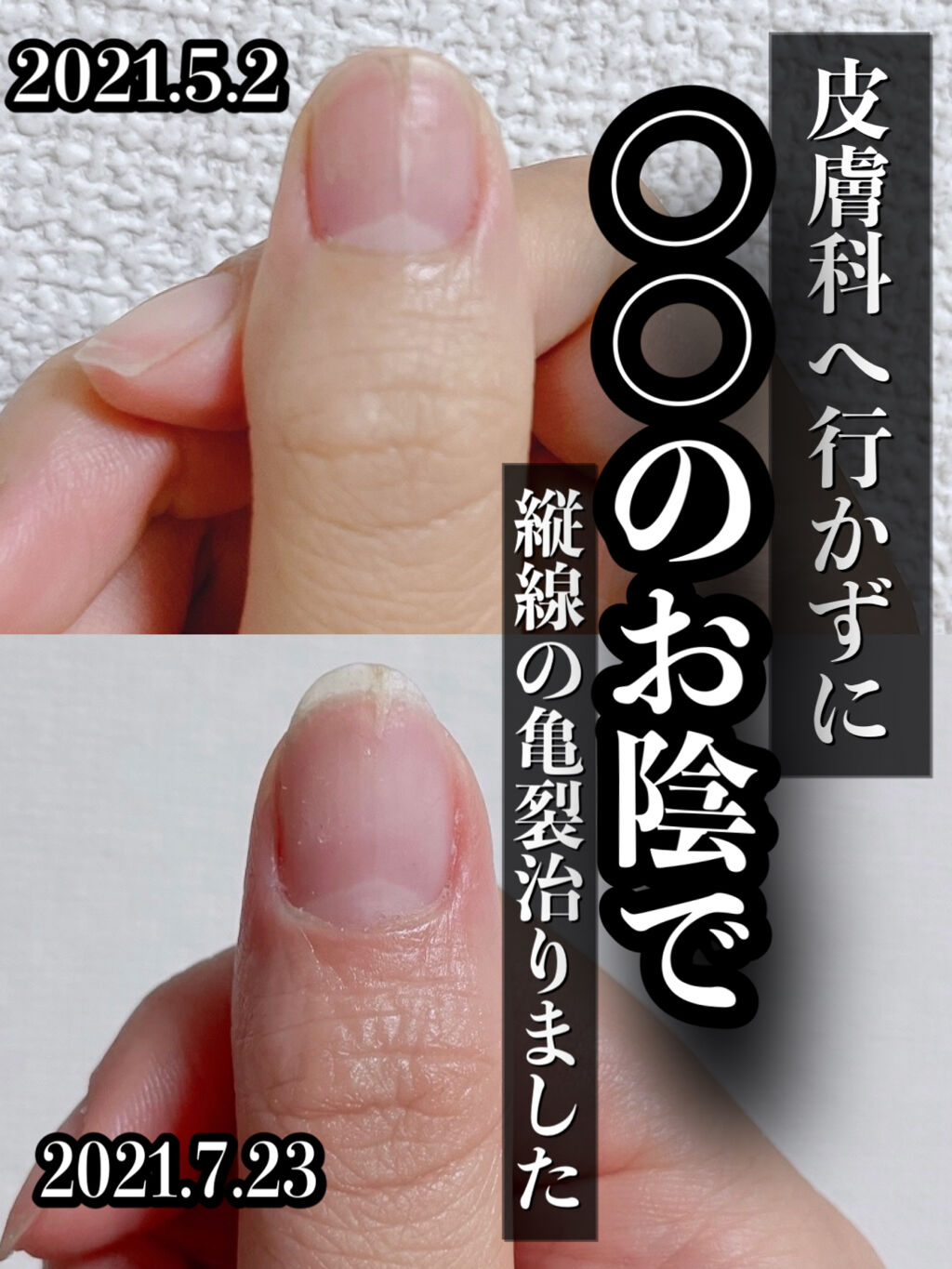 デイケアオイル/Dr.Nail/ネイルオイル・トリートメントを使ったクチコミ（1枚目）