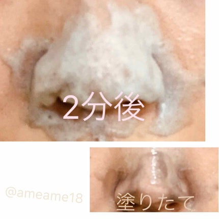 JUSO KURO PACK/NAKUNA-RE/洗い流すパック・マスクを使ったクチコミ(2枚目)