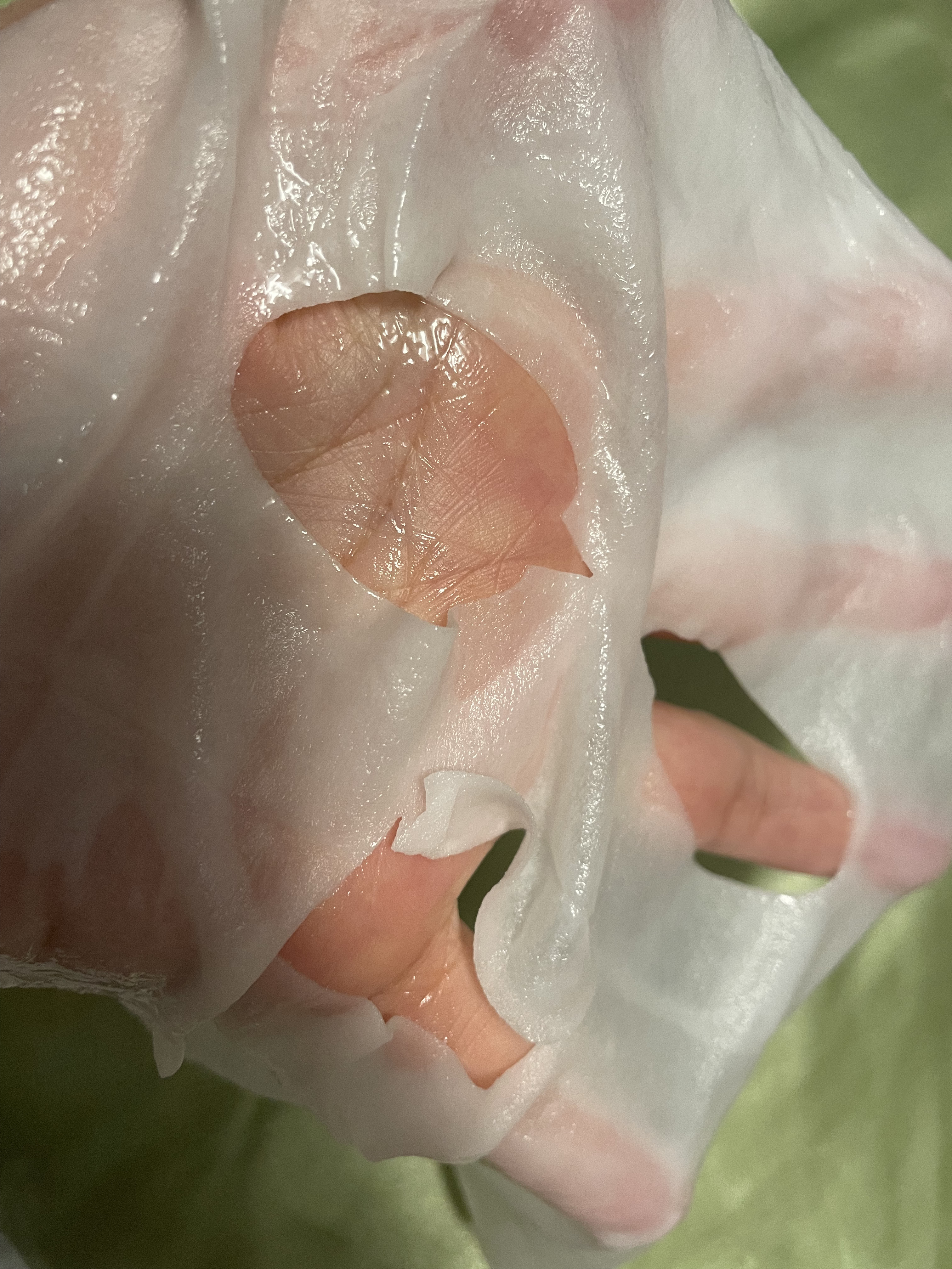 D:NA プロアチンマスク/MEDIHEAL/シートマスク・パックを使ったクチコミ（2枚目）