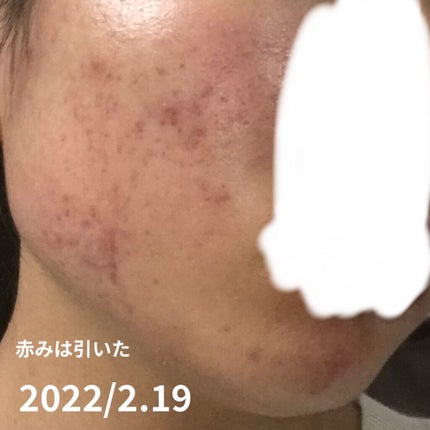 を使ったクチコミ(3枚目)