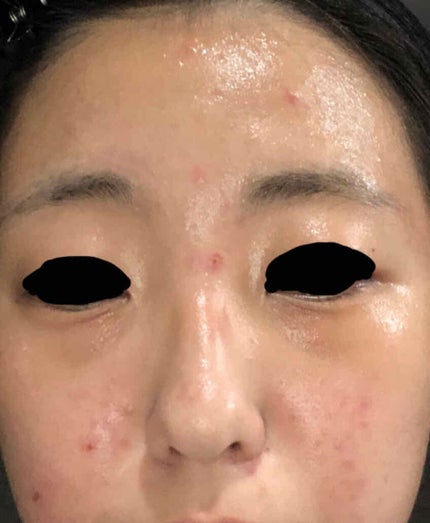 ハトムギ保湿ジェル(ナチュリエ スキンコンディショニングジェル)/ナチュリエ/美容液を使ったクチコミ(2枚目)