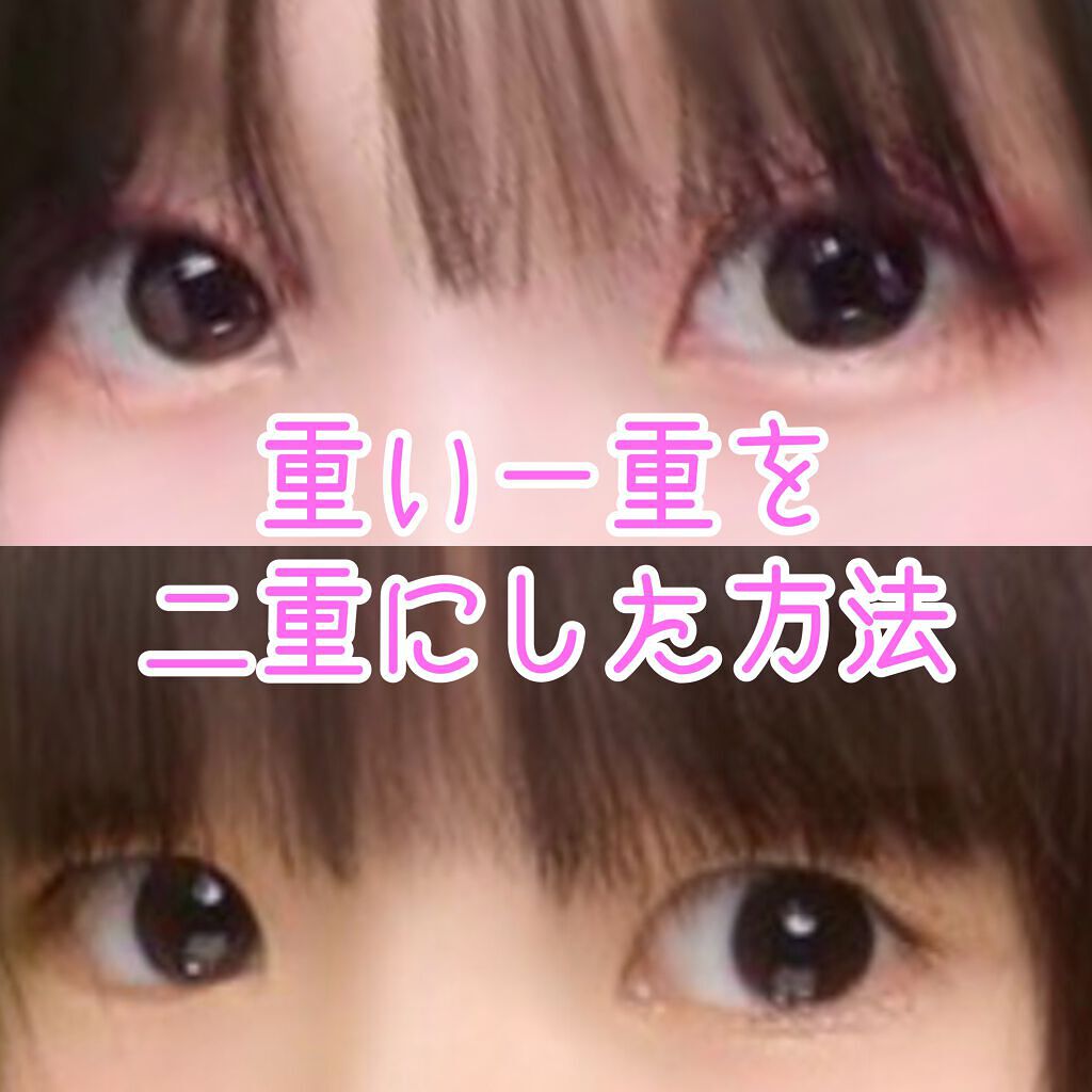 のびーるアイテープ(絆創膏タイプ、レギュラー)/DAISO/二重まぶた用アイテムを使ったクチコミ(1枚目)