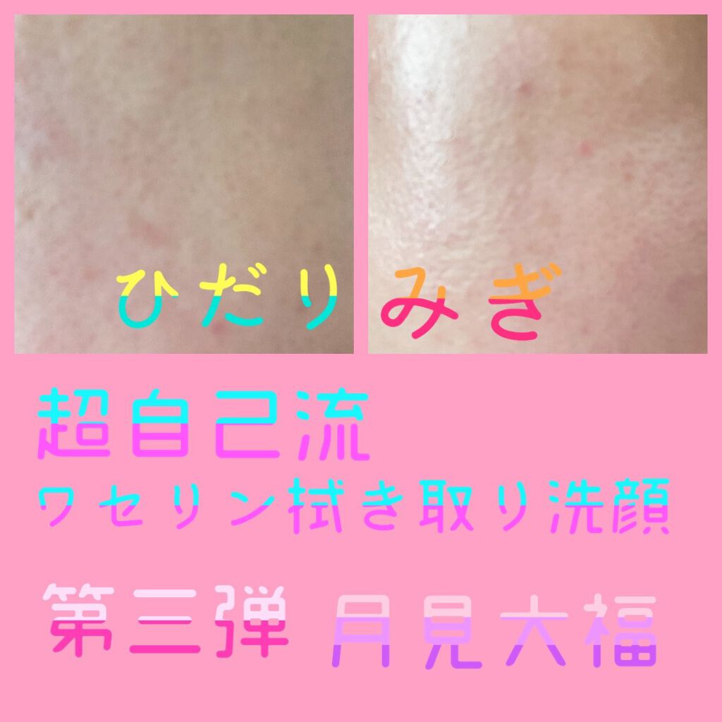 月見大福 on LIPS 「♡第三弾、超自己流ワセリン拭き取り洗顔♡ーーーーーーーーーー❤..」(1枚目)