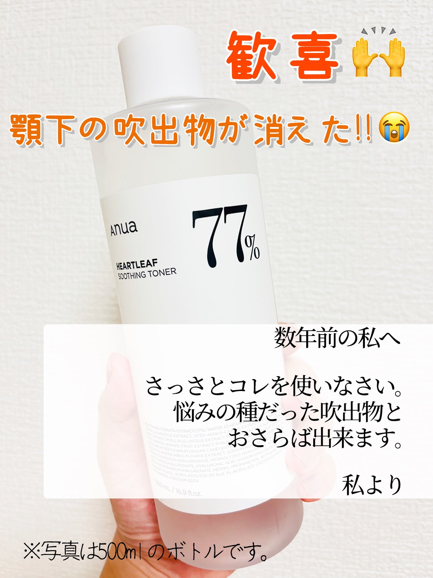 ドクダミ 77 スージングトナー/Anua/化粧水を使ったクチコミ(1枚目)