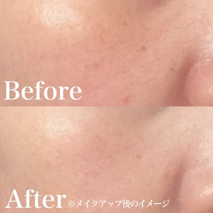 薬用 リンクルホワイト クッションBB/ONLY MINERALS/クッションファンデーションを使ったクチコミ(4枚目)