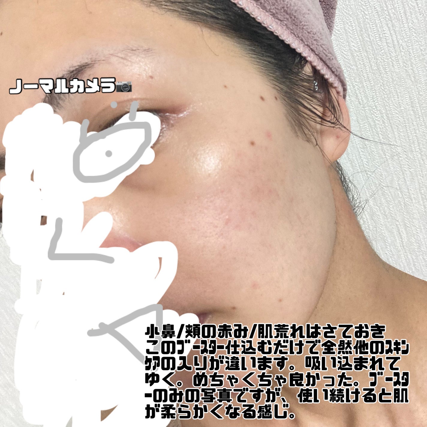 RXザ・6ペプチドスキンブースターセラム/COSRX/ブースター・導入液を使ったクチコミ(3枚目)