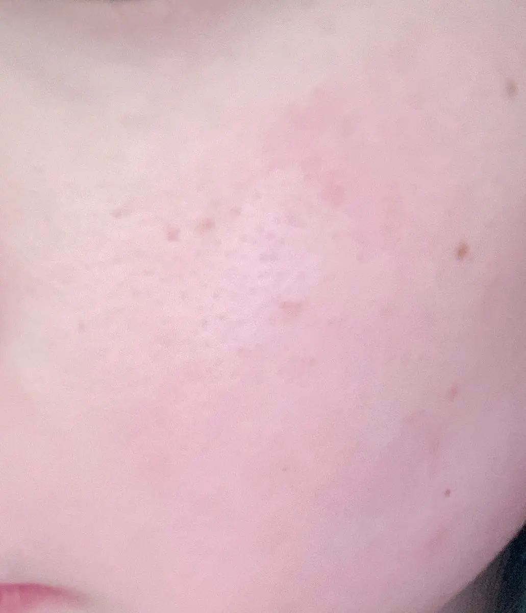 1番 塗るパントテン酸スージングクリーム/numbuzin/フェイスクリームを使ったクチコミ（2枚目）