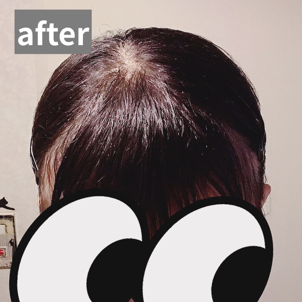 スーパーキープヘアスプレイ＜エクストラハード＞ 無香料/VO5/ヘアスプレーを使ったクチコミ（3枚目）