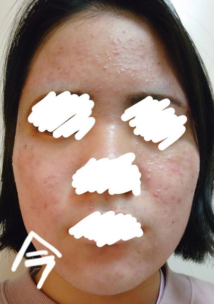 菊正宗 日本酒の化粧水 高保湿/菊正宗/化粧水を使ったクチコミ(3枚目)