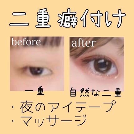 アイテープ 埋没式両面テープ/DAISO/二重まぶた用アイテムを使ったクチコミ(1枚目)