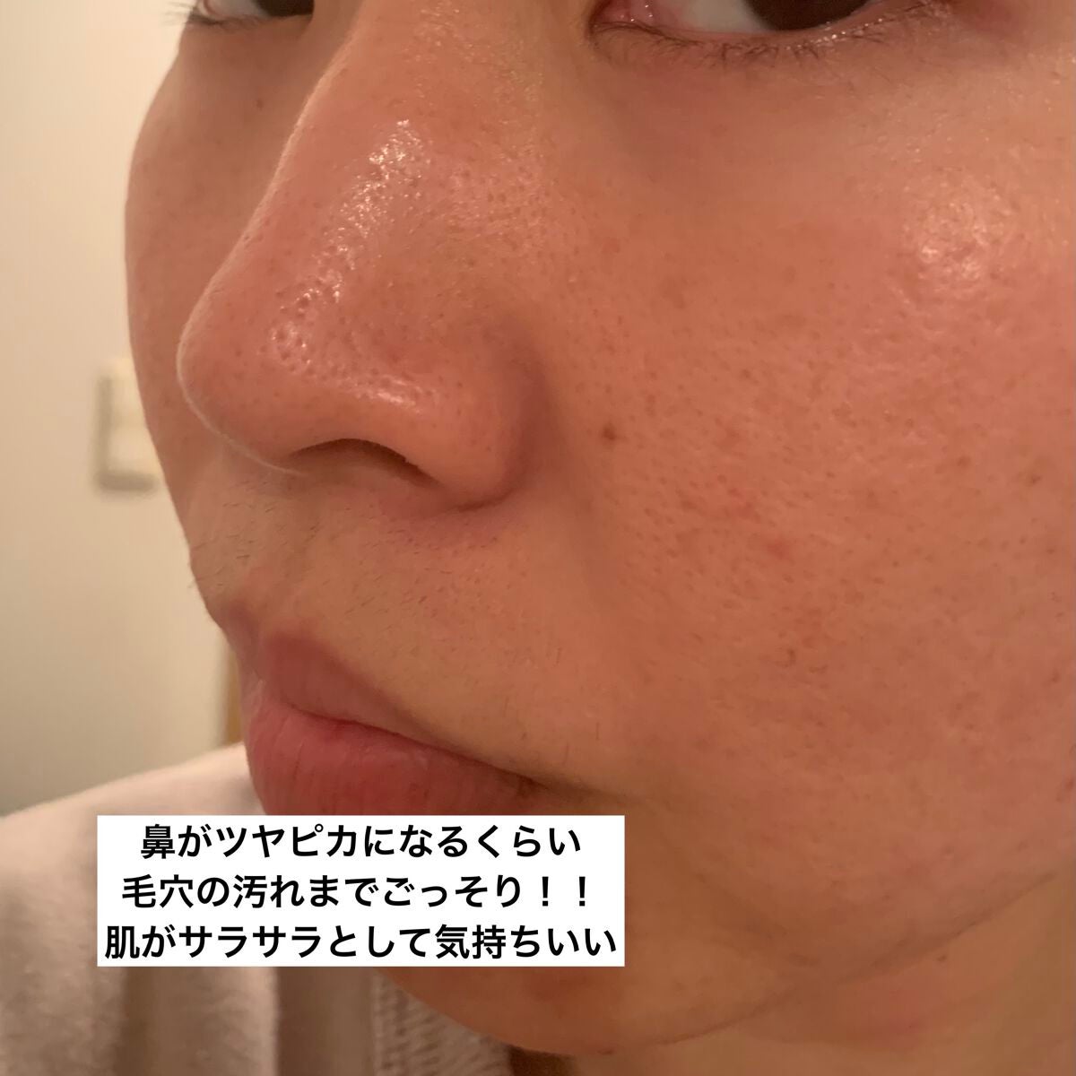 ニベア クリアビューティー弱酸性泡洗顔 もっちり美肌/ニベア/泡洗顔を使ったクチコミ(7枚目)