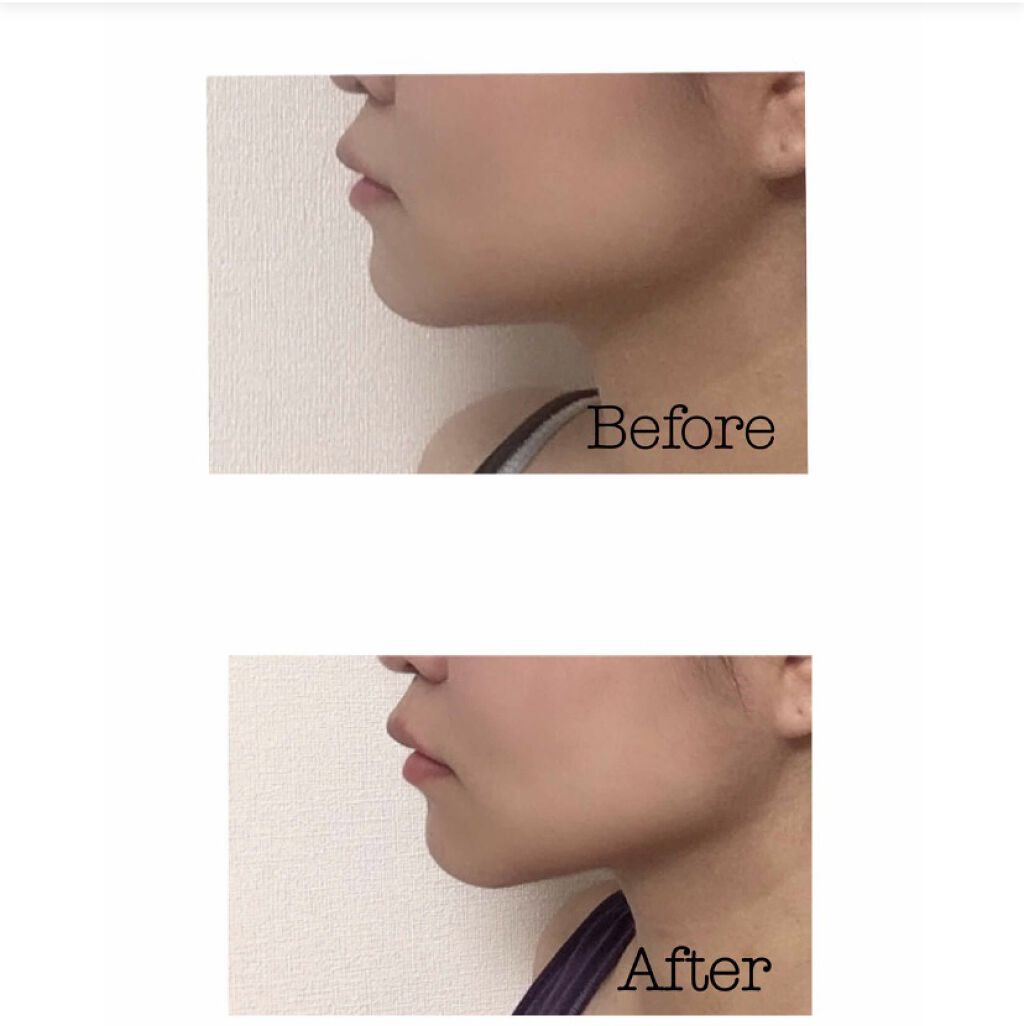 モイスチャライザーAGARISM/AGARISM/フェイスクリームを使ったクチコミ（2枚目）