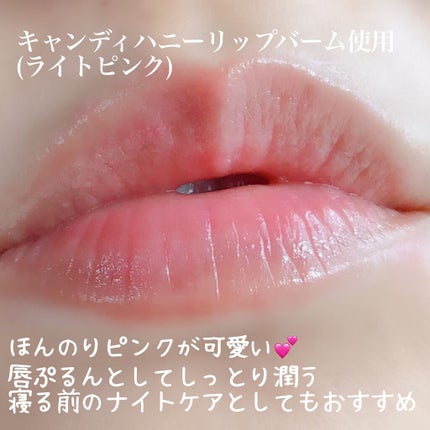 YNM キャンディーハニーリップバーム/YNM/リップバームを使ったクチコミ(4枚目)