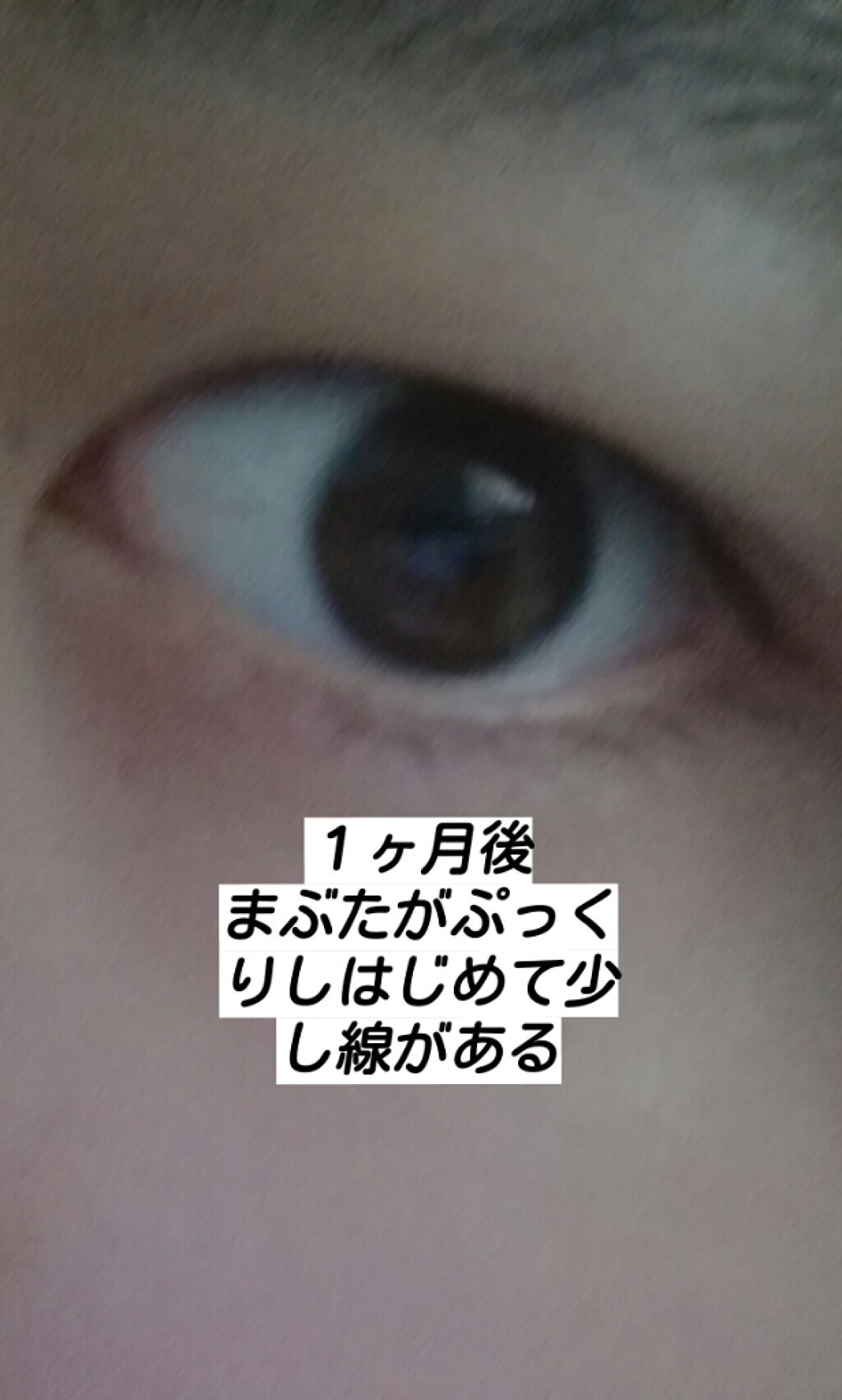 ダブルアイリキッド/Automatic Beauty/二重まぶた用アイテムを使ったクチコミ（3枚目）