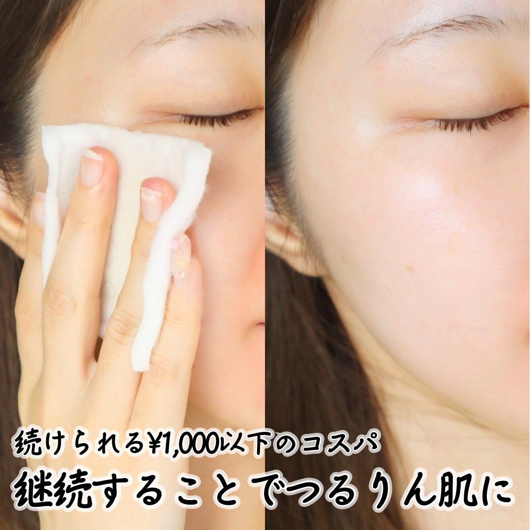 ネイチャーコンク 薬用クリアローション/ネイチャーコンク/拭き取り化粧水を使ったクチコミ(5枚目)