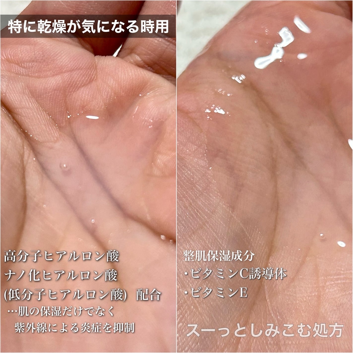 ネイチャーコンク 薬用 クリアローションとてもしっとり/ネイチャーコンク/拭き取り化粧水を使ったクチコミ(5枚目)