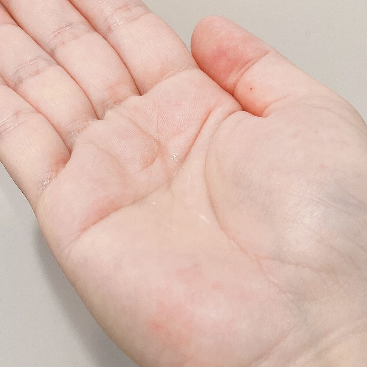 エファクラ ピールケア セラム/ラ ロッシュ ポゼ/美容液を使ったクチコミ（3枚目）