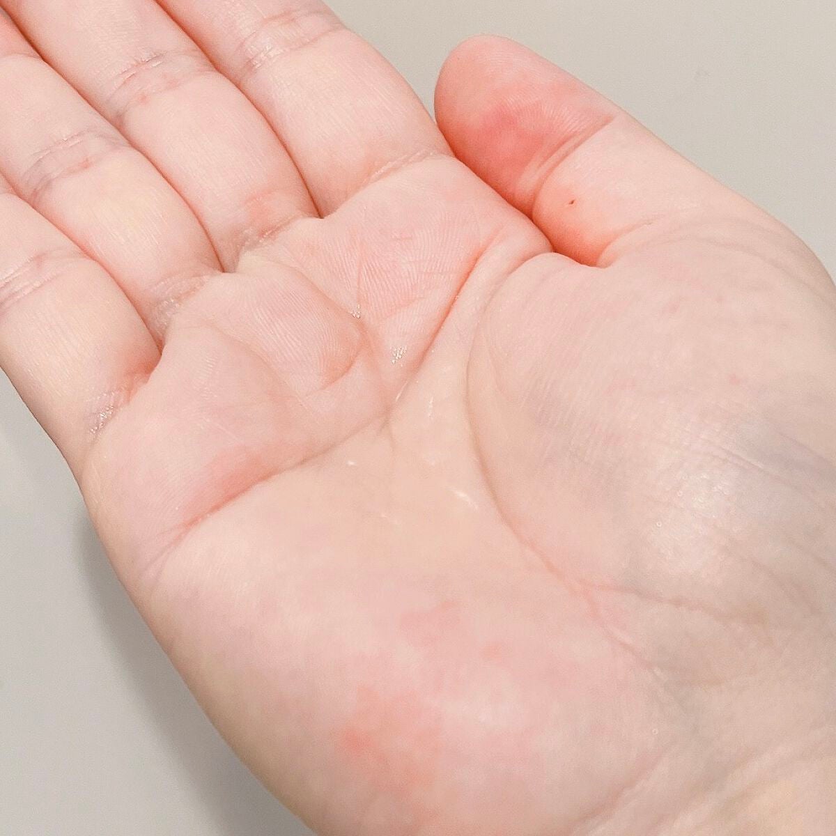 エファクラ ピールケア セラム/ラ ロッシュ ポゼ/美容液を使ったクチコミ(3枚目)