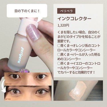 スポッツカバー ファウンデイション/SHISEIDO/クリームコンシーラーを使ったクチコミ（5枚目）