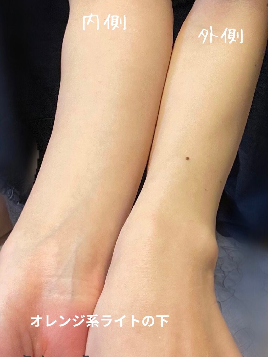 サンバリア100 サンバリア100を使った口コミ 白いかどうか別として腕の内側と外側はほぼ同 By Chico 敏感肌 Lips サンバリア100 サンバリア100を使った口コミ 白いかどうか別として腕の内側と外側はほぼ同 By Chico 敏感肌 Lips