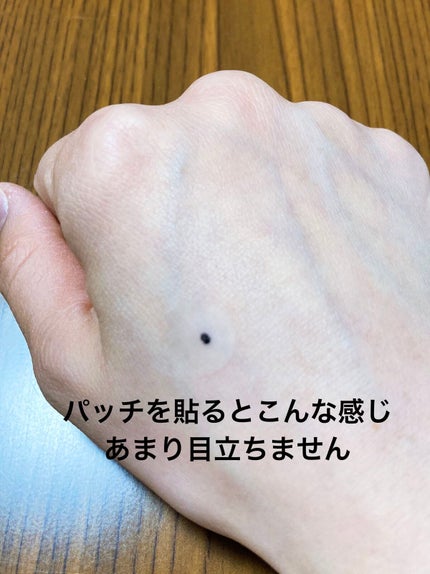 極薄透明パッチ nikipa!/金冠堂/にきびパッチを使ったクチコミ(3枚目)