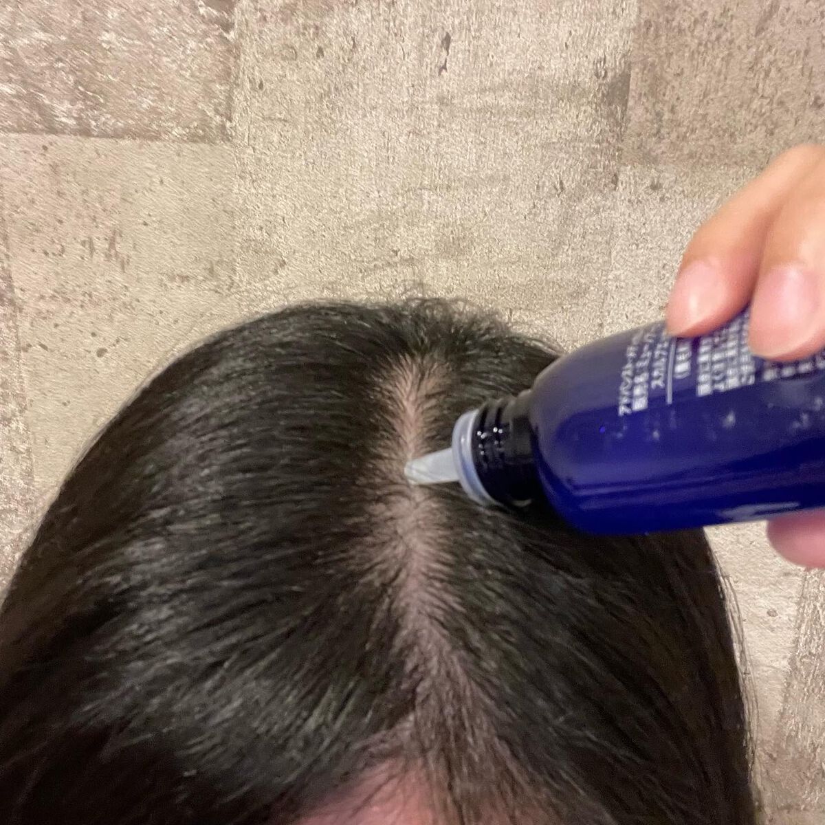 Wアプローチヘアプログラム/MUNOAGE(ミューノアージュ)/頭皮ローションを使ったクチコミ（2枚目）