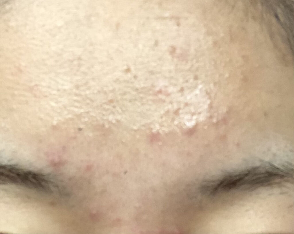 白潤プレミアム薬用浸透美白化粧水/肌ラボ/化粧水を使ったクチコミ（3枚目）