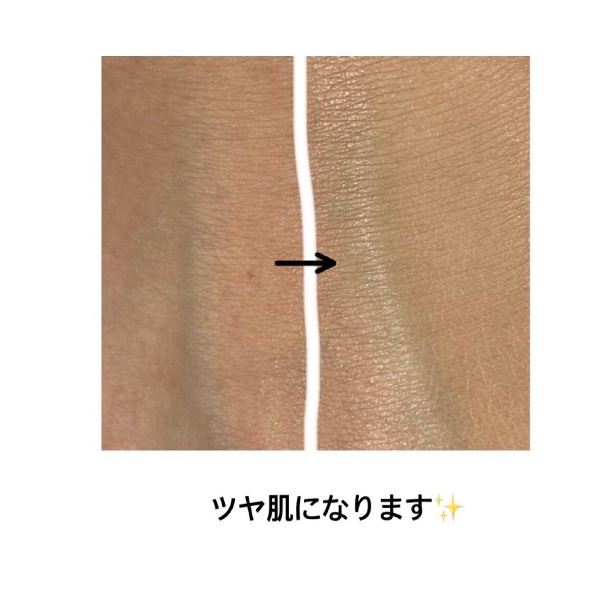 CICAレッドネスモイスチャーカバークッション/VT/クッションファンデーションを使ったクチコミ(3枚目)