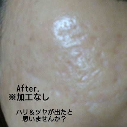 弱酸性pHシートマスク ドクダミフィット/Abib /シートマスク・パックを使ったクチコミ(4枚目)