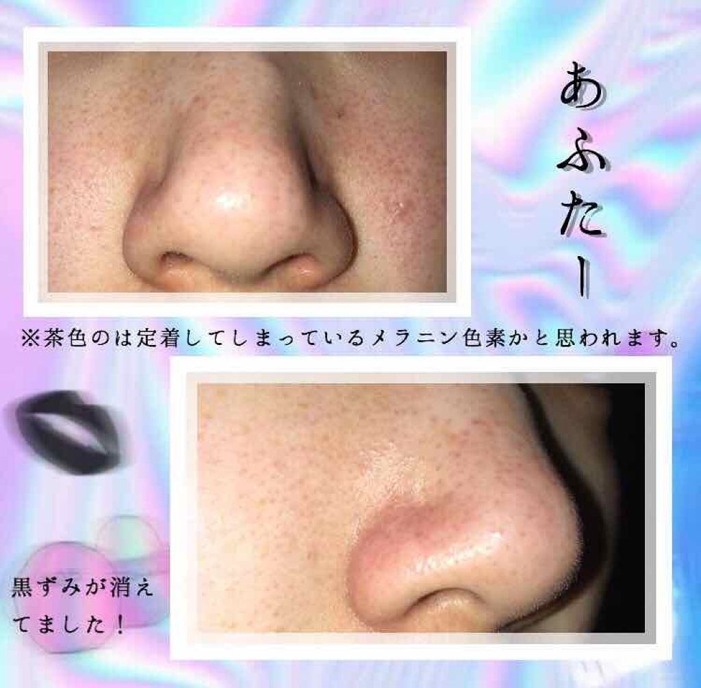 酵素配合角栓スティック石けん/コジット/スクラブ・ゴマージュを使ったクチコミ(3枚目)