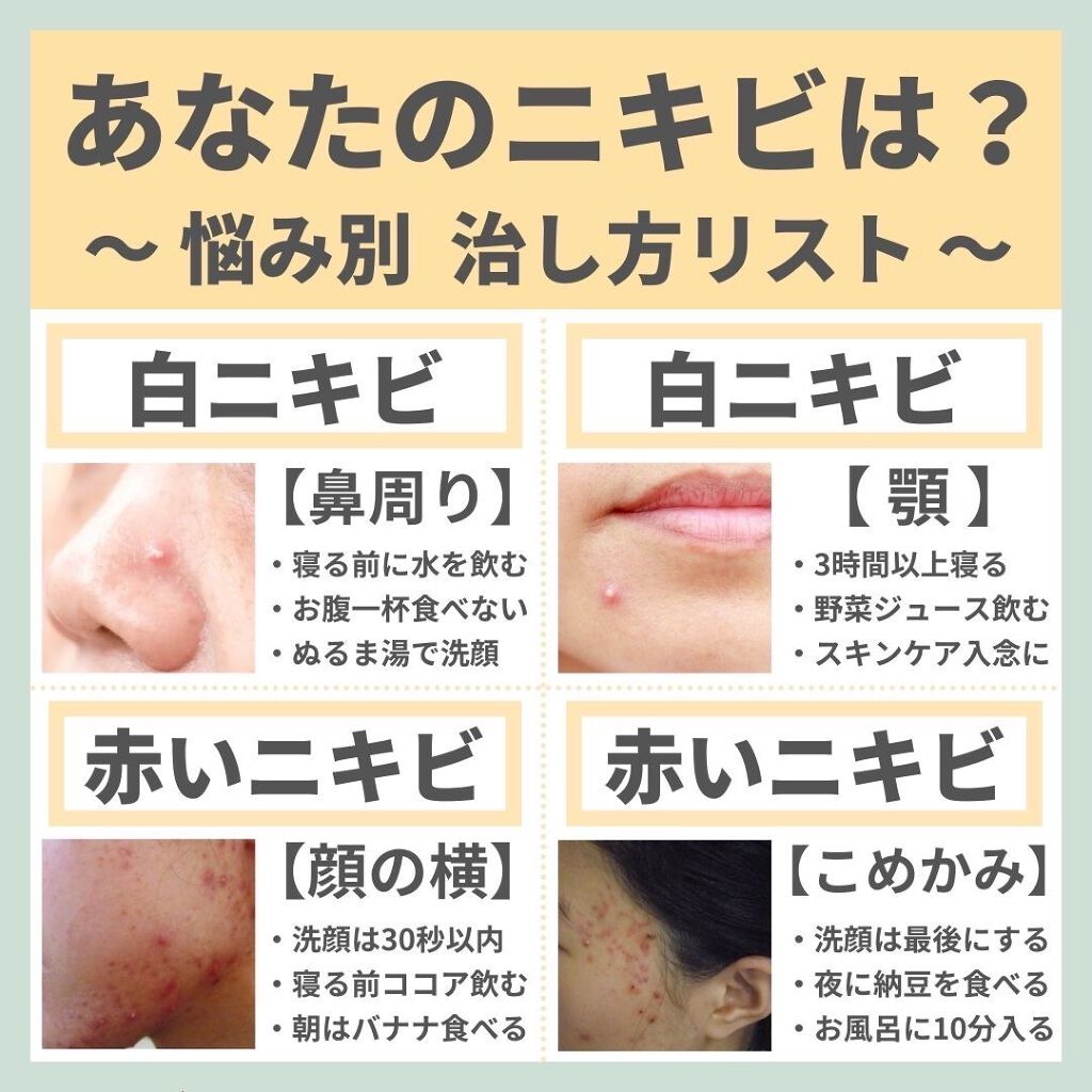 あなたの肌に合ったスキンケア💐コーくん先生 on LIPS 「『よかった!!』『超タメになった!』と思ったら、...『いいね..」(1枚目)