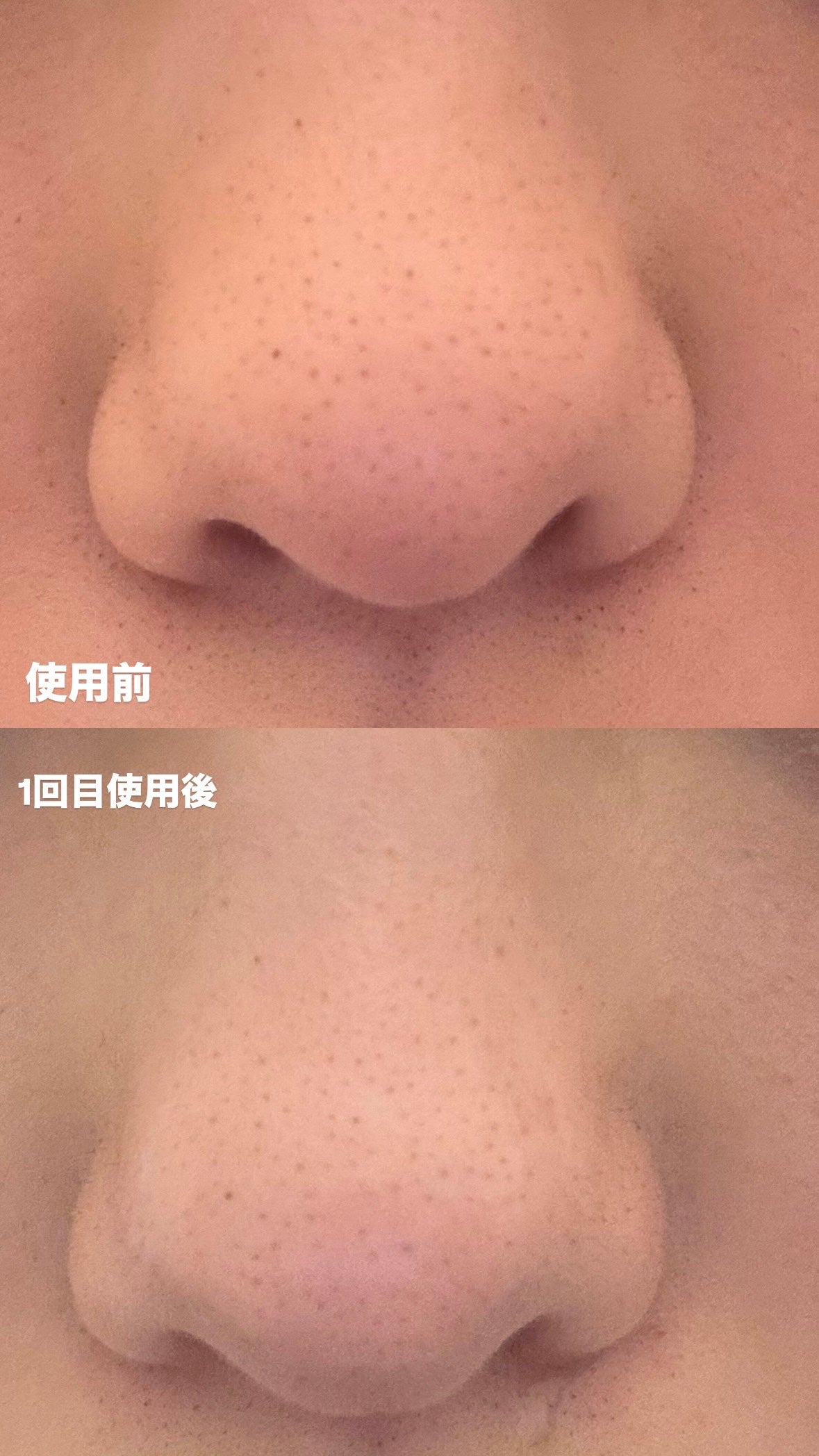 パーフェクトワンフォーカス スムースクレンジングバーム ディープブラック/PERFECT ONE FOCUS/クレンジングバームを使ったクチコミ(2枚目)