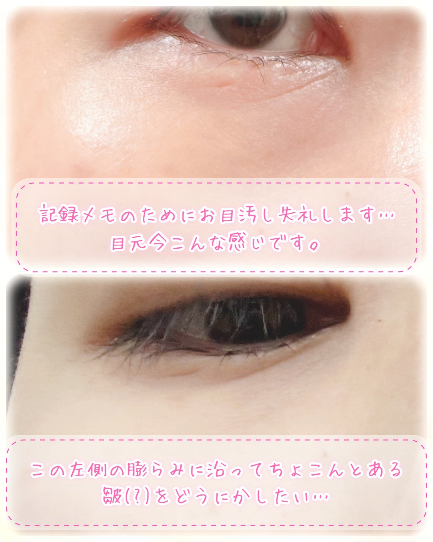 ゴールドコラーゲンパーフェクションアイパッチ/SNP/シートマスク・パックを使ったクチコミ(4枚目)