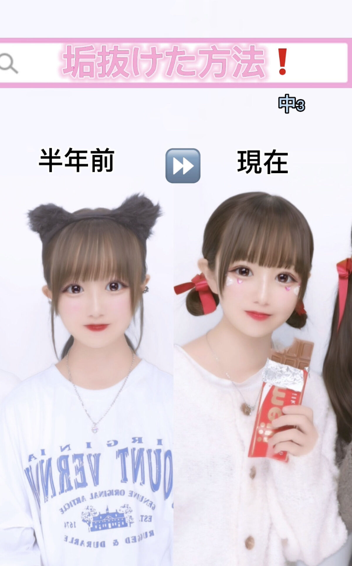 のびーるアイテープ（絆創膏タイプ、レギュラー）/DAISO/二重まぶた用アイテムを使ったクチコミ（1枚目）