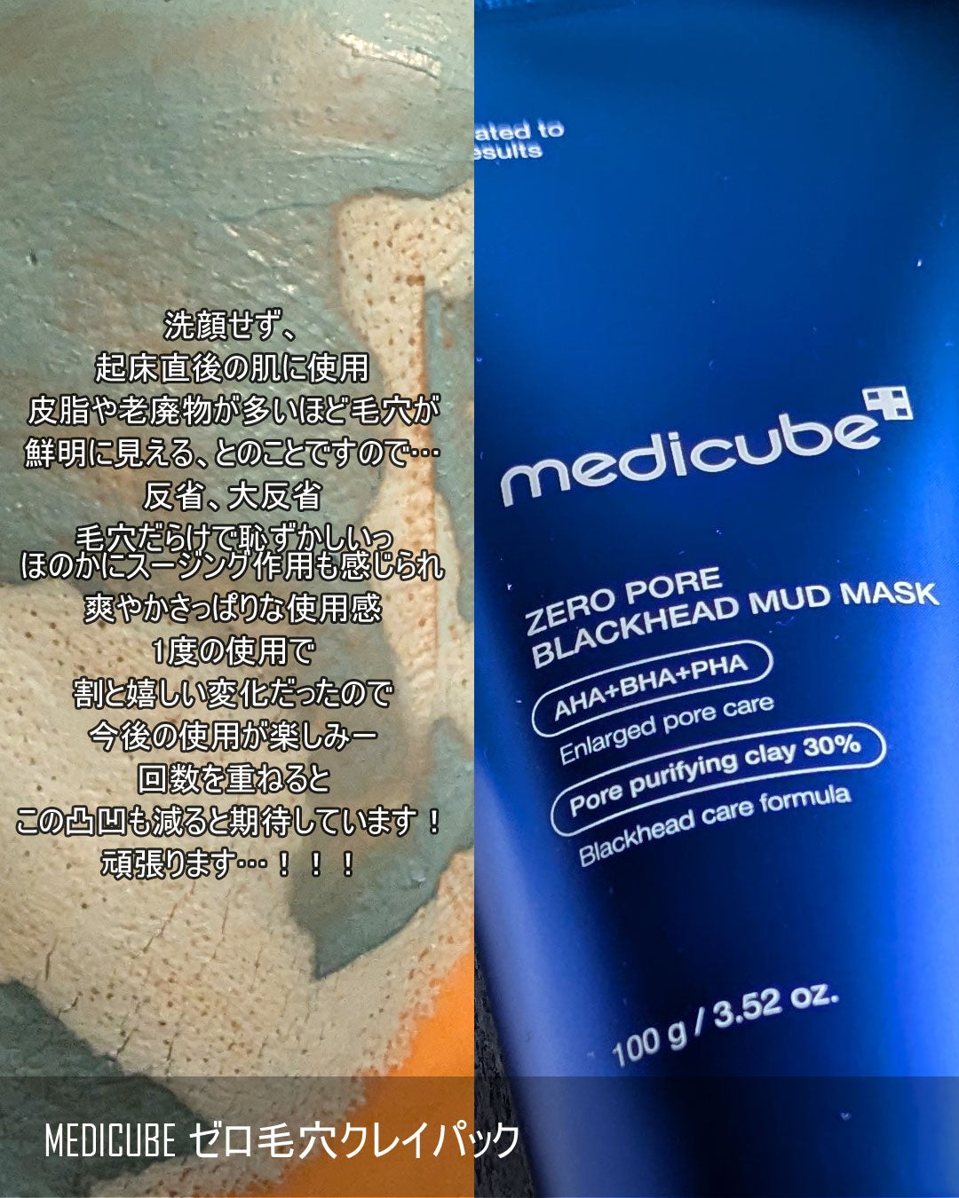 ゼロ毛穴クレイパック/MEDICUBE/洗い流すパック・マスクを使ったクチコミ(7枚目)