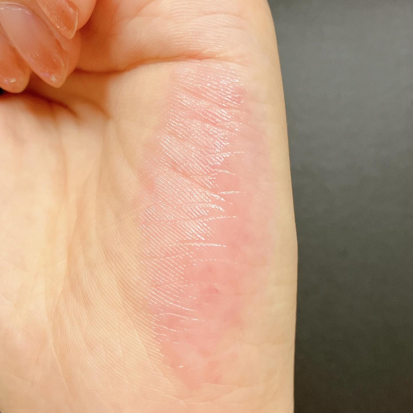 ティントリップレスキュー/FRESHO2/リップバームを使ったクチコミ(9枚目)